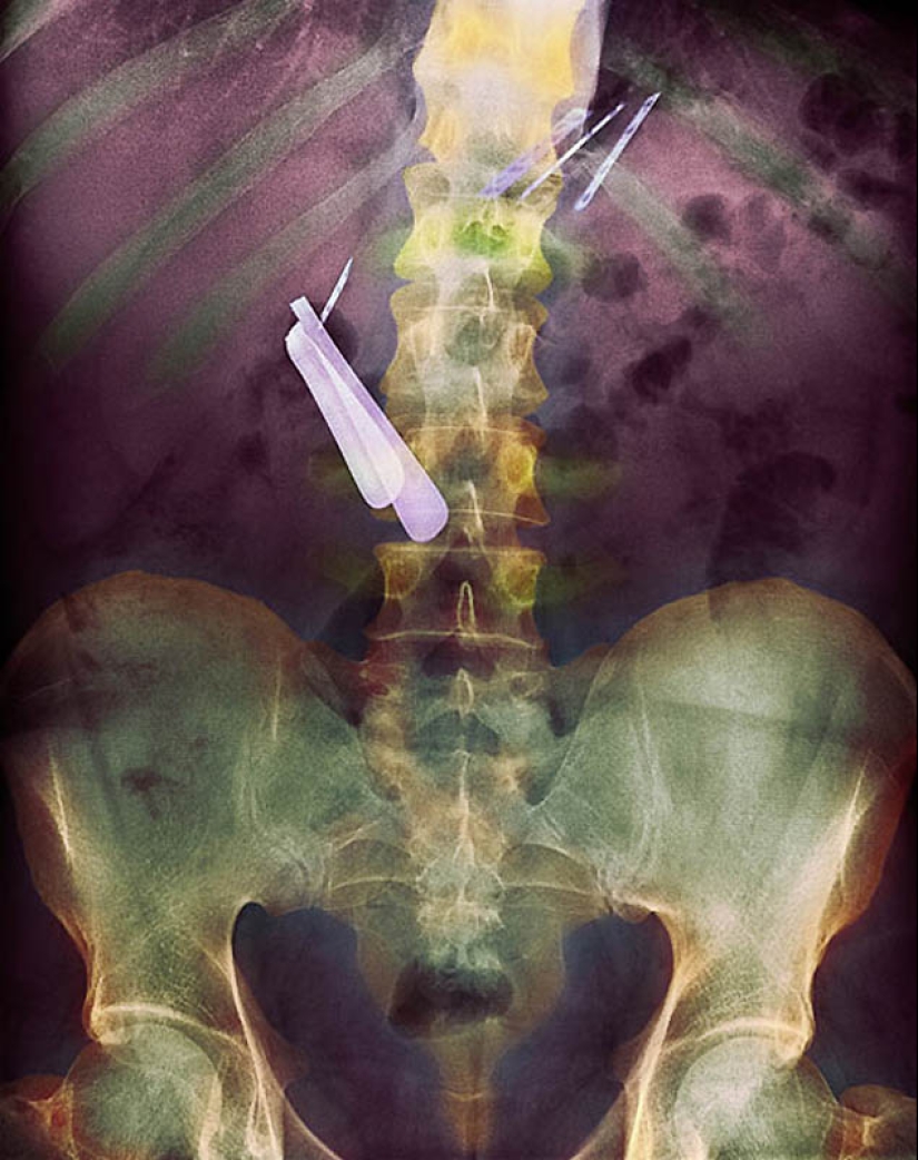 The strangest X-rays