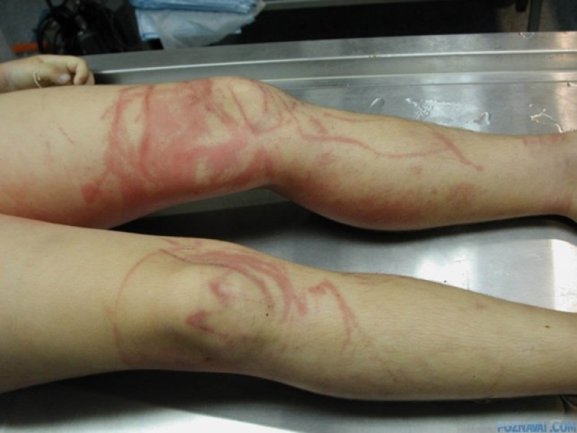 The touch of the "hand of death", or Why they bathe in pantyhose in the north of Australia