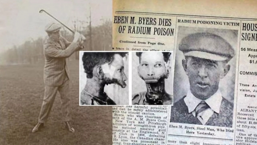 The tragic story of Eben Byers, who was treated with radium The tragic story of Eben Byers, who was treated with radium