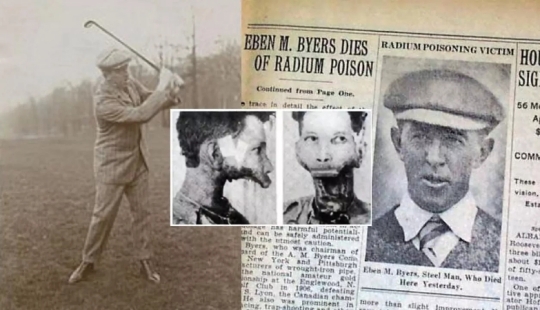 The tragic story of Eben Byers, who was treated with radium The tragic story of Eben Byers, who was treated with radium