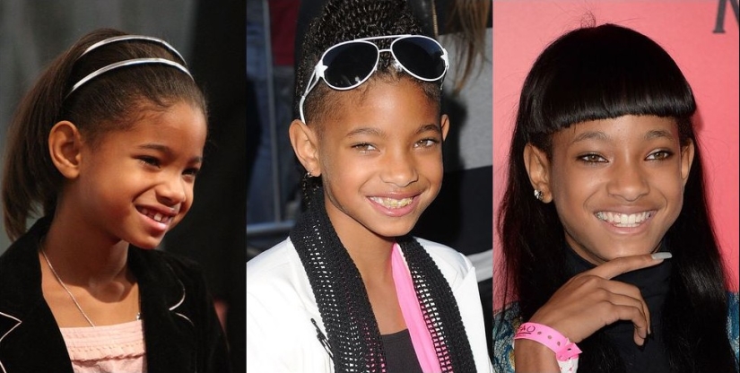 These celebrities will show you how braces can dramatically change your smile.