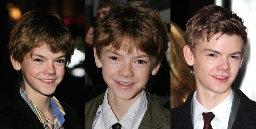 These celebrities will show you how braces can dramatically change your smile.