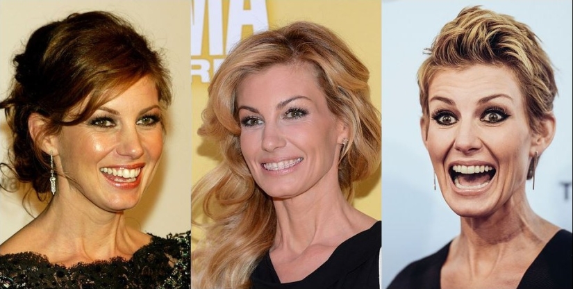 These celebrities will show you how braces can dramatically change your smile.