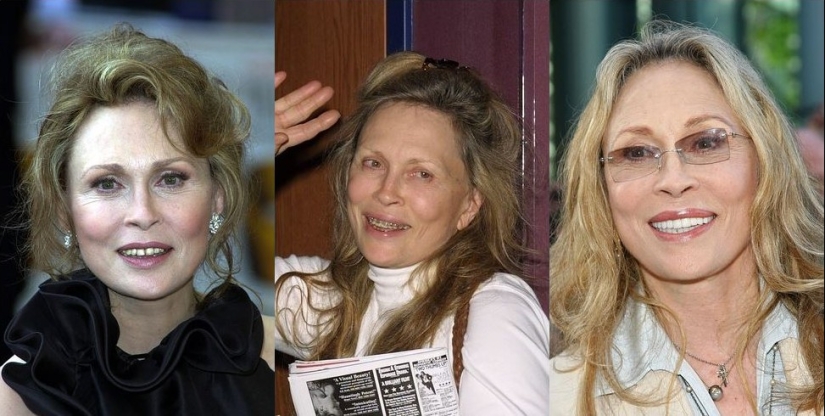 These celebrities will show you how braces can dramatically change your smile.