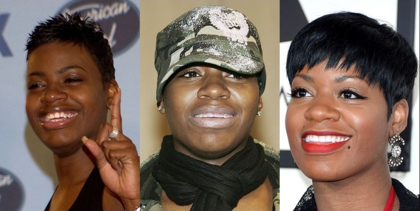 These celebrities will show you how braces can dramatically change your smile.