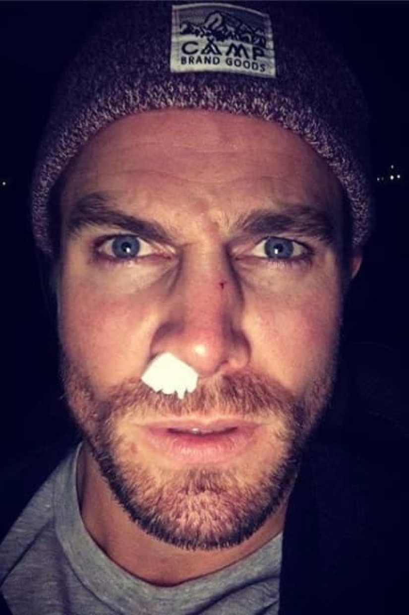 Un actor es una profesión peligrosa! Lesiones reales de estrellas en el set