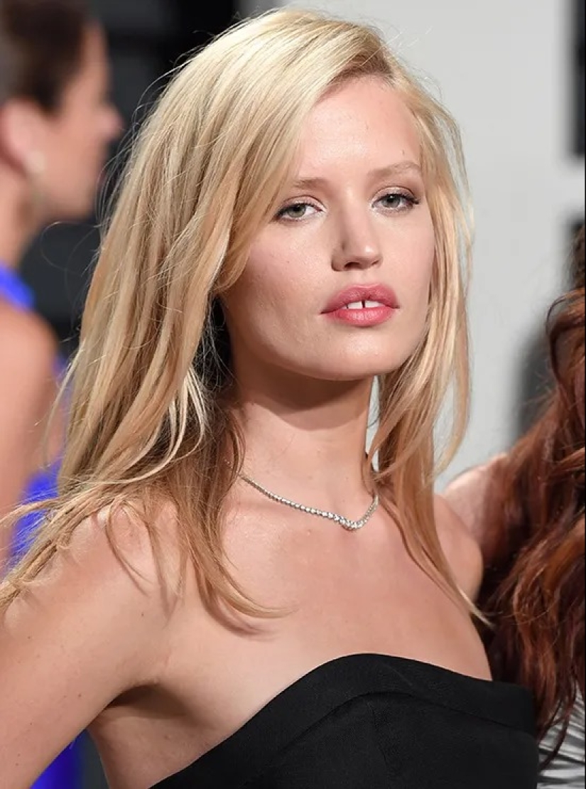 ¿Un defecto o un punto culminante? Madonna y otras estrellas con un hueco entre los dientes ¿Un defecto o un punto culminante? Madonna y otras estrellas con un hueco entre los dientes