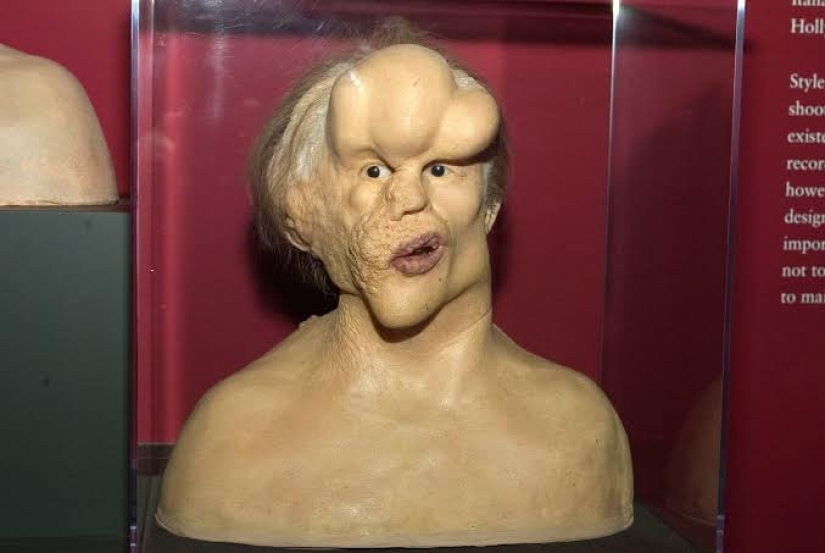 Un Fenómeno con un Alma Hermosa: La historia de Joseph Merrick - El Hombre Elefante