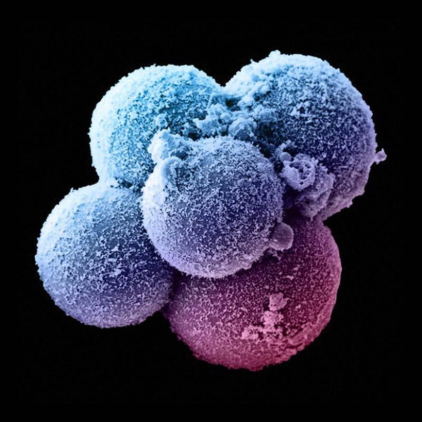 Unique photos: a girl's life before birth
