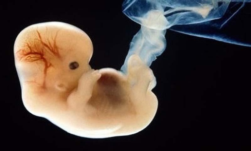 Unique photos: a girl's life before birth