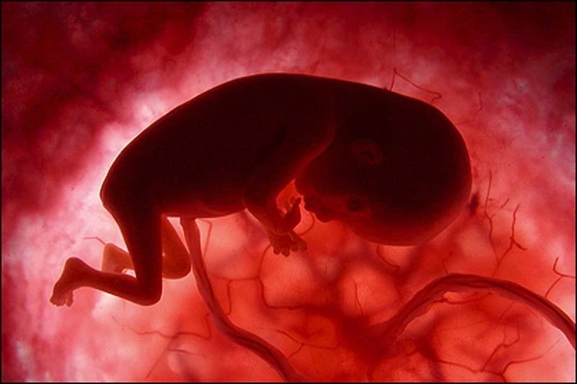 Unique photos: a girl's life before birth