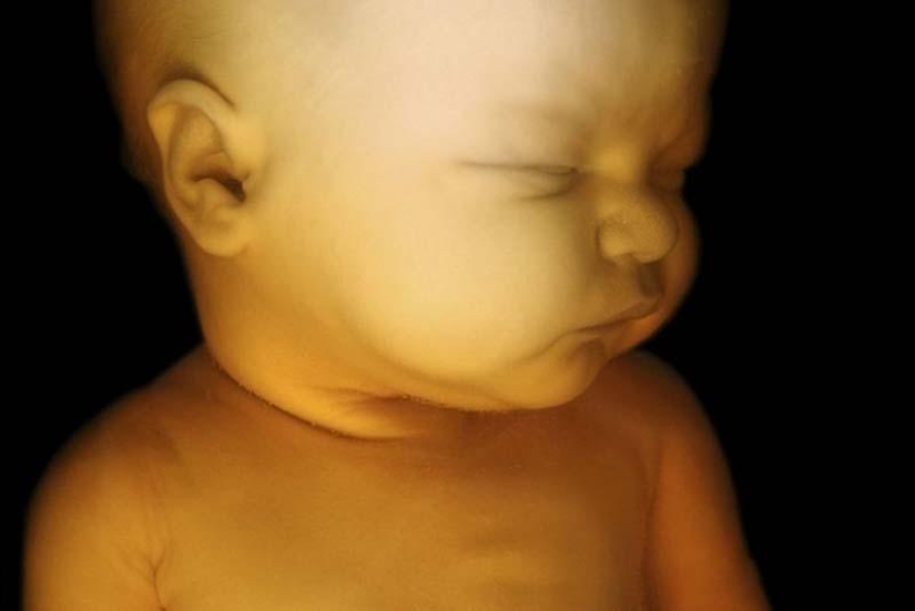 Unique photos: a girl's life before birth