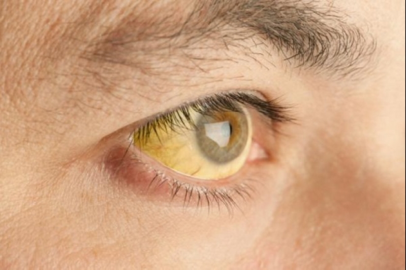 What a rest! Dangerous diseases you can catch abroad