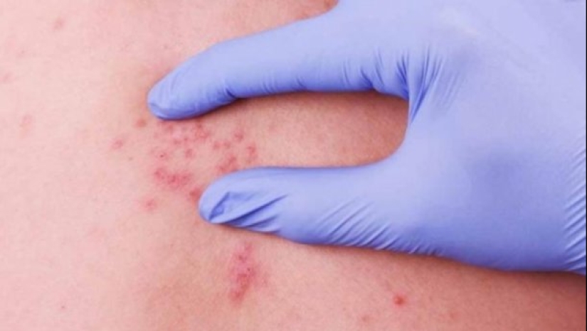 What a rest! Dangerous diseases you can catch abroad