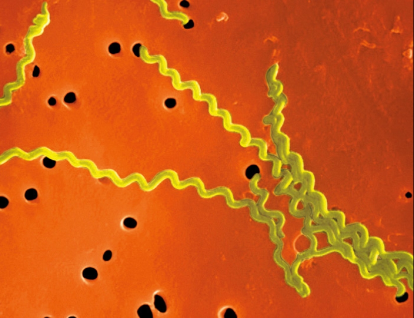 What a rest! Dangerous diseases you can catch abroad