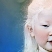 What do albinos of different nationalities and races look like What do albinos of different nationalities and races look like