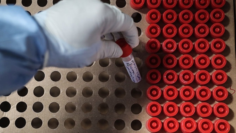 Where the Russian had II blood group, which is called "the peasant"
