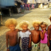 Why are dark-skinned blondes born in the Solomon Islands Why are dark-skinned blondes born in the Solomon Islands