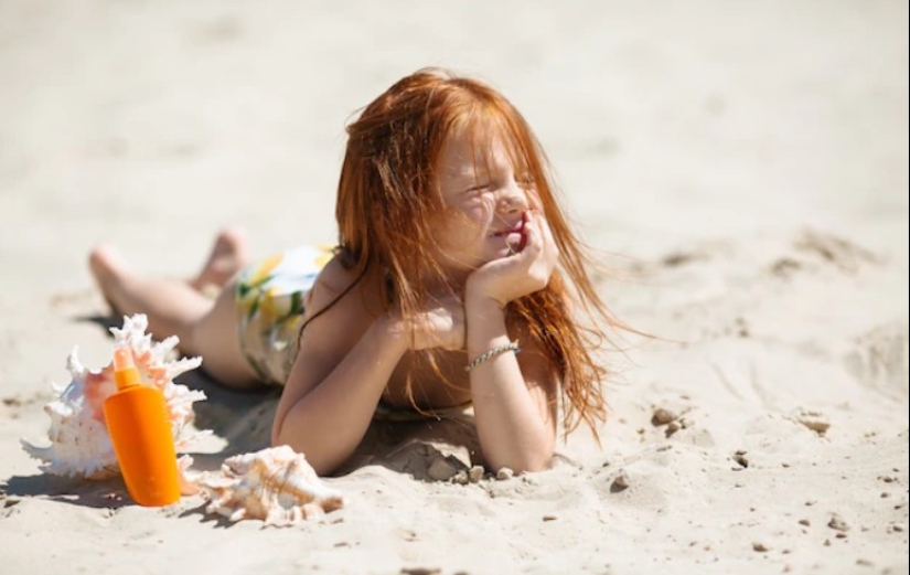 Why do redheads feel pain differently than others Why do redheads feel pain differently than others