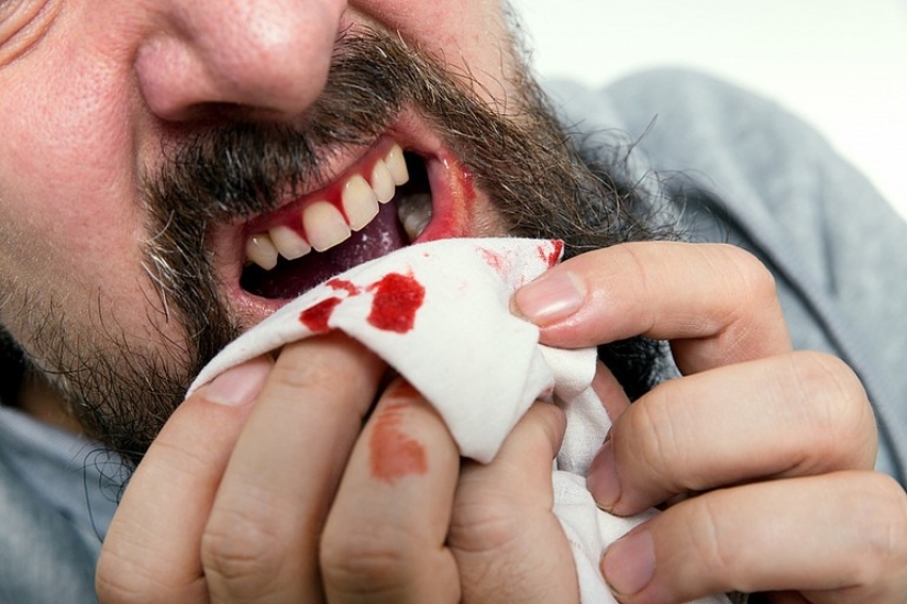 Why do you dream about tooth loss Why do you dream about tooth loss
