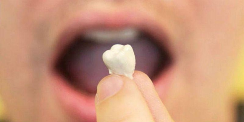 Why do you dream about tooth loss Why do you dream about tooth loss