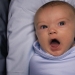 Why is circumcision so popular in the United States? And it's not about hygiene or religion at all Why is circumcision so popular in the United States? And it's not about hygiene or religion at all