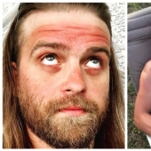 You need to sunbathe wisely, and here are 22 proofs