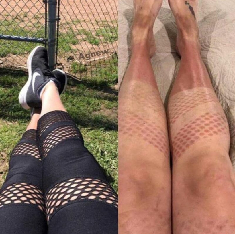 You need to sunbathe wisely, and here are 22 proofs You need to sunbathe wisely, and here are 22 proofs
