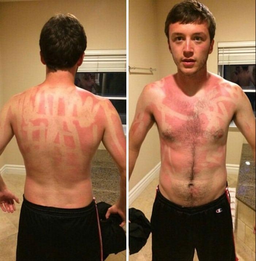 You need to sunbathe wisely, and here are 22 proofs You need to sunbathe wisely, and here are 22 proofs
