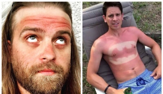 You need to sunbathe wisely, and here are 22 proofs