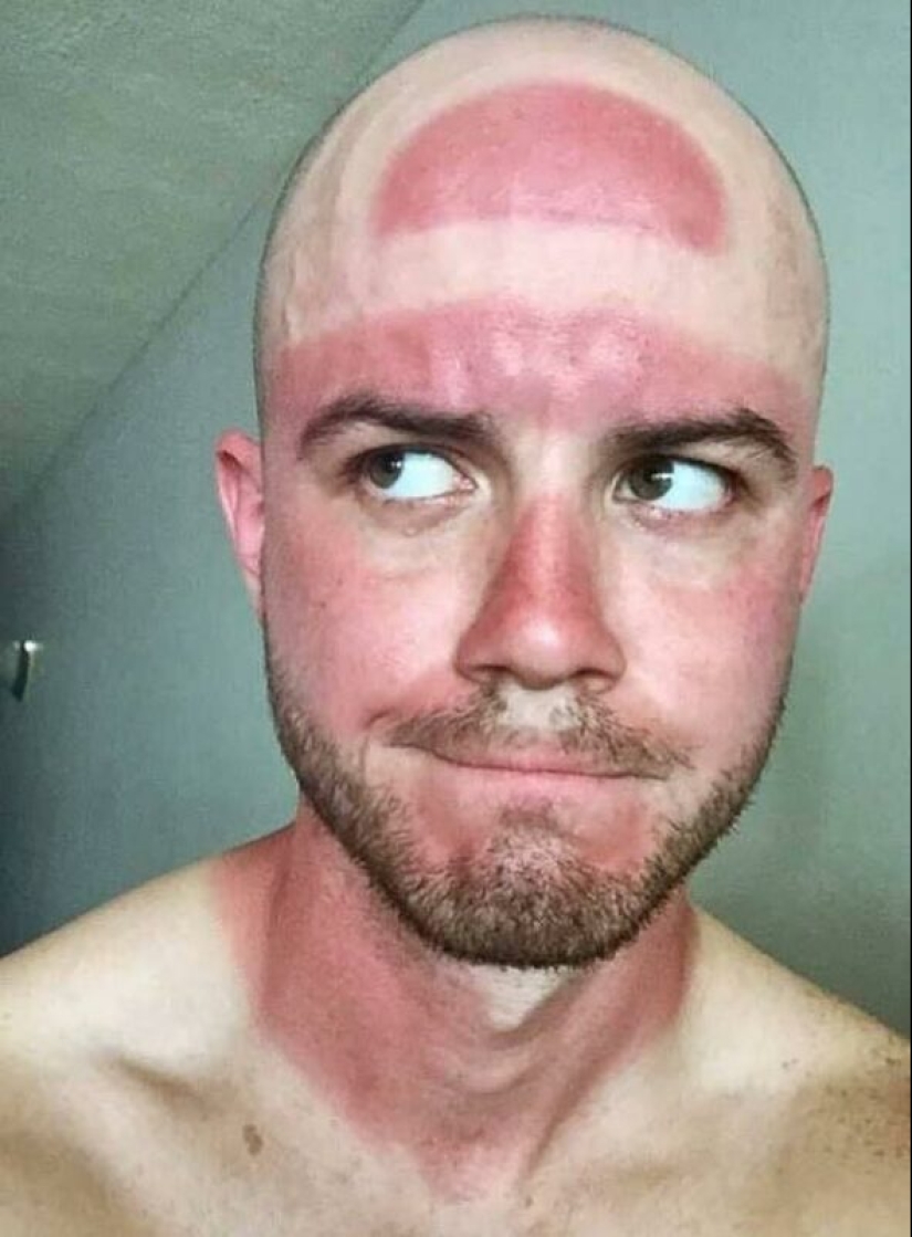 You need to sunbathe wisely, and here are 22 proofs You need to sunbathe wisely, and here are 22 proofs