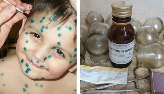 Zelenka y plátano todas las enfermedades: todo sobre la casa de la medicina en la URSS